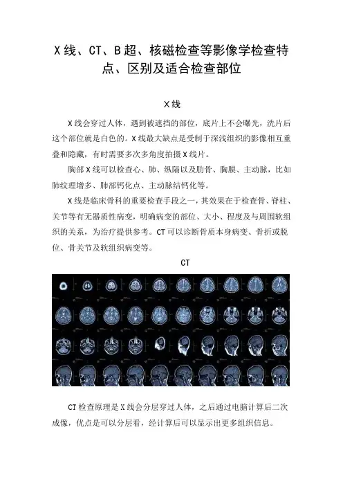 X线、CT、B超、核磁检查等影像学检查特点、区别及适合检查部位