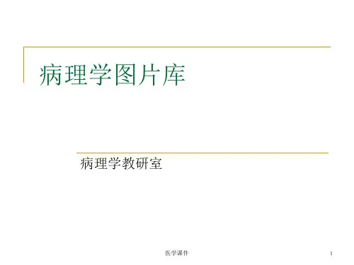 病理学图片库  PPT课件