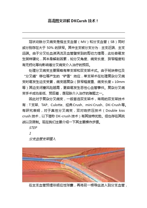 高清图文详解DKCursh技术！