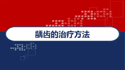 龋齿的治疗方法 PPT