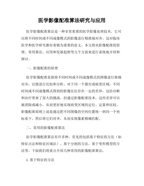 医学影像配准算法研究与应用