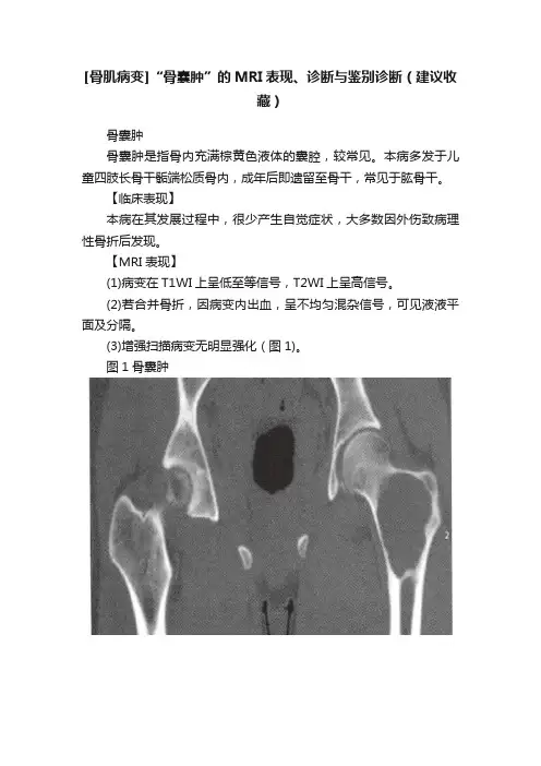 [骨肌病变]“骨囊肿”的MRI表现、诊断与鉴别诊断（建议收藏）