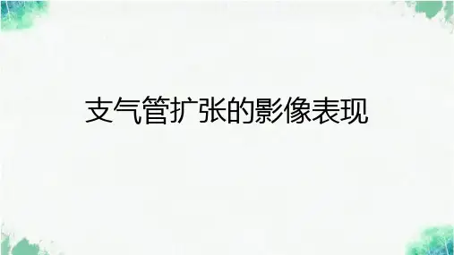 支气管扩张的影像表现