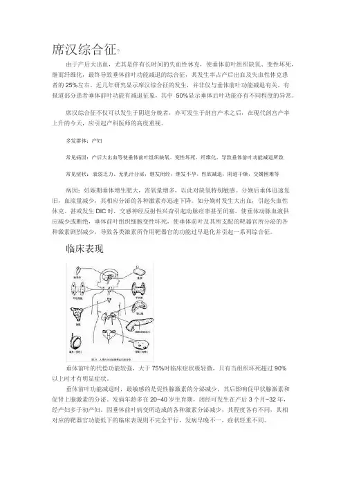 席汉思综合征