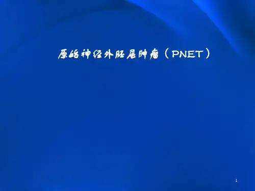 原始神经外胚层肿瘤精品PPT课件