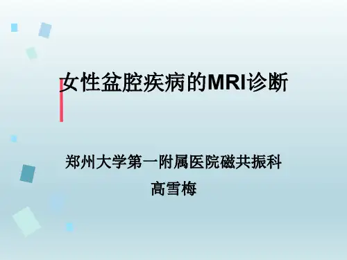 女性盆腔疾病的MRI诊断