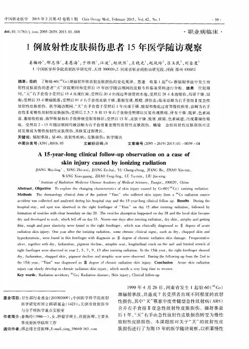 1例放射性皮肤损伤患者15年医学随访观察