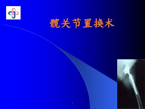 髋关节置换术讲PPT课件