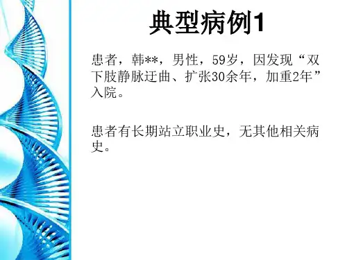 静脉曲张专家讲课-泡沫硬化剂应用病例分享-257