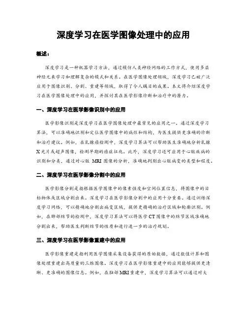 深度学习在医学图像处理中的应用
