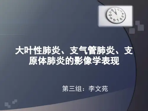 大叶性肺炎 PPT课件