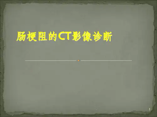 肠梗阻的CT影像诊断PPT课件