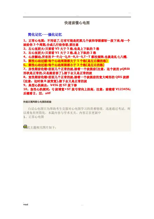手把手教你读心电图(图解)