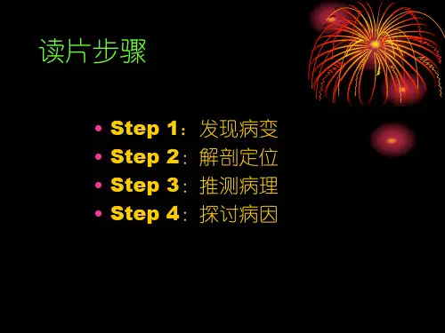 胸片读片技巧图片量大PPT课件