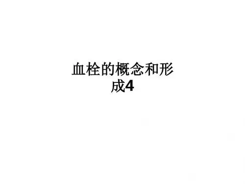 血栓的概念和形成4ppt课件