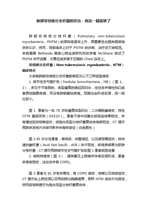 肺部非结核分支杆菌的诊治：看这一篇就够了