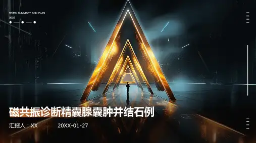 磁共振诊断精囊腺囊肿并结石例