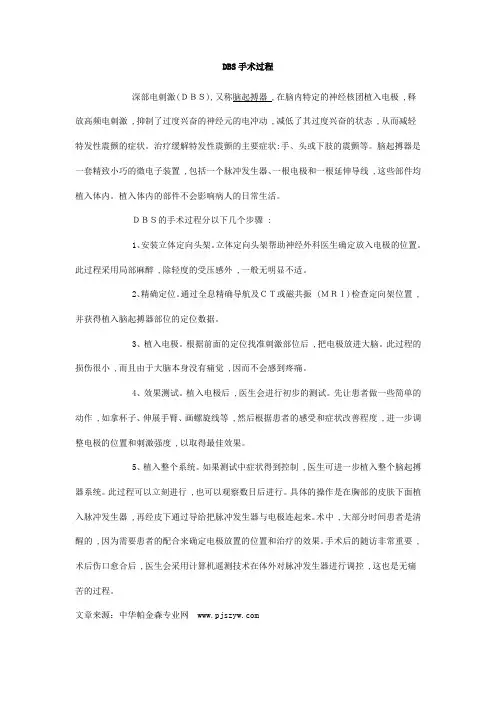 脑起搏器手术的过程