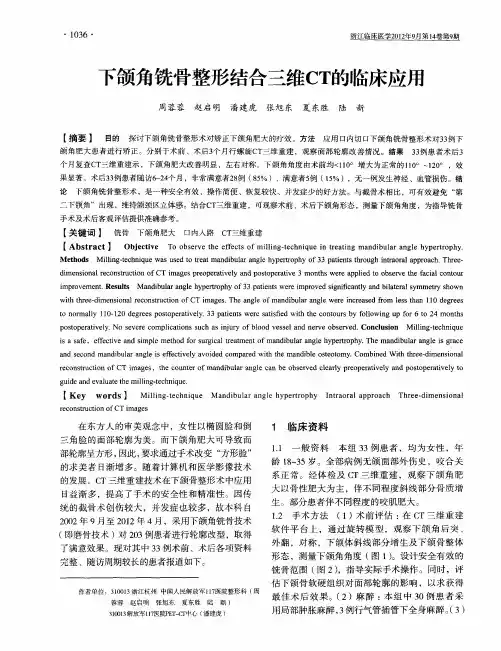 下颌角铣骨整形结合三维CT的临床应用