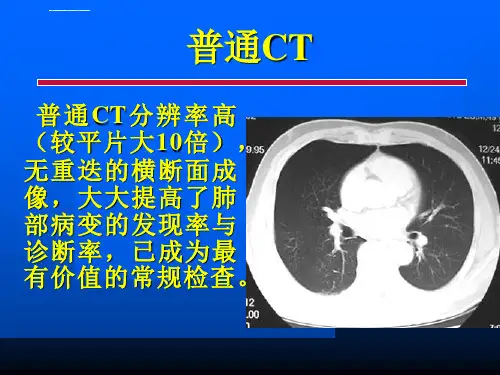胸部各种影像学检查-常见病的CT诊断ppt课件