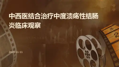 中西医结合治疗中度溃疡性结肠炎临床观察