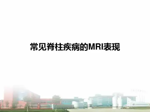 常见脊柱疾病的MRI表现 PPT课件