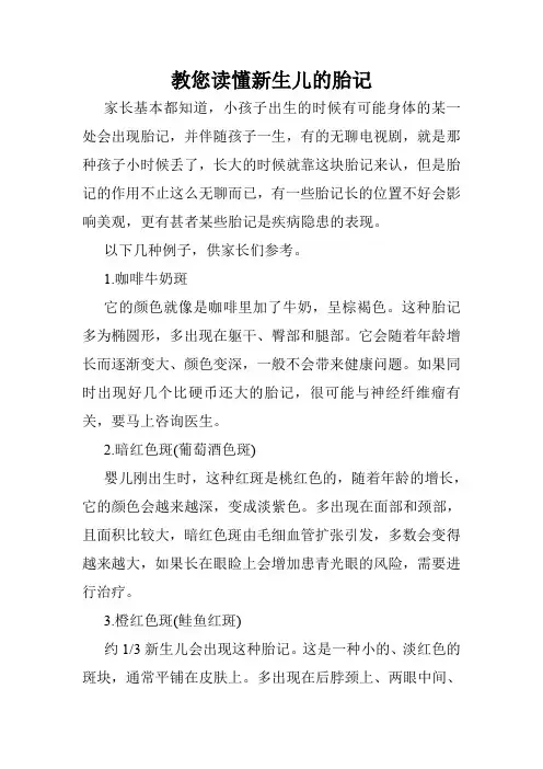 教您读懂新生儿的胎记