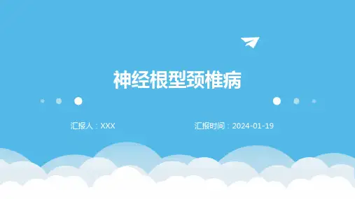 神经根型颈椎病演示ppt课件