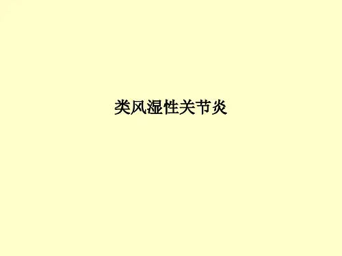 类风湿性关节炎PPT课件