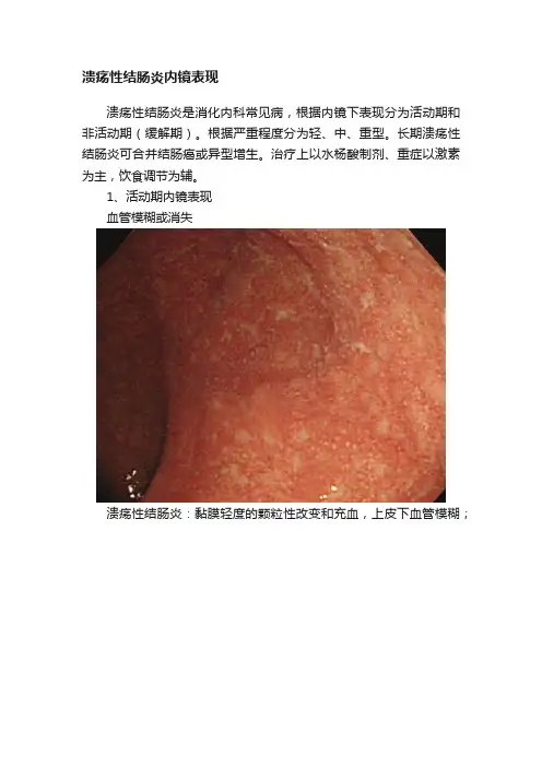 溃疡性结肠炎内镜表现
