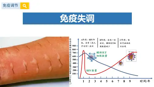 免疫失调课件-高二生物人教版选择性必修1