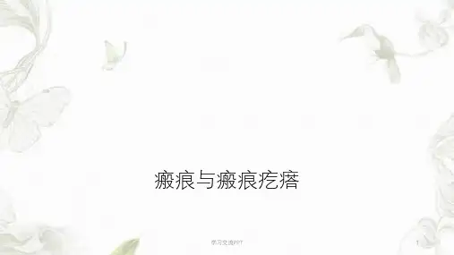 瘢痕与瘢痕疙瘩ppt课件