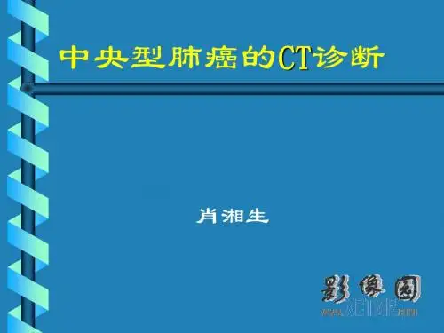中央型肺癌的CT诊断——肖湘生资料