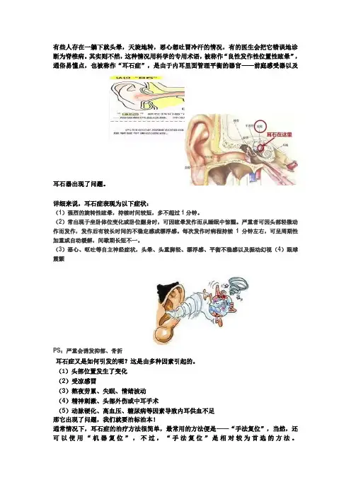 神经内科健康知识宣传“耳石症”