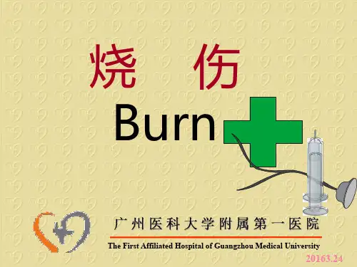 【外科学学习课件】_烧伤