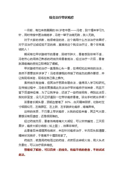 线灸治疗带状疱疹