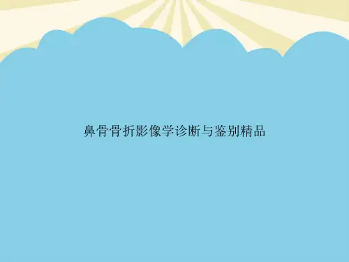 【正式版】鼻骨骨折影像学诊断与鉴别精品PPT资料