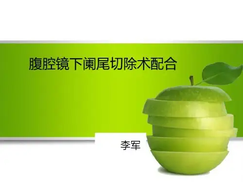 腹腔镜下阑尾切除术配合