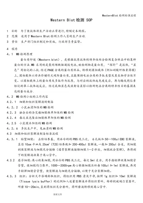 WesternBlot检测标准流程