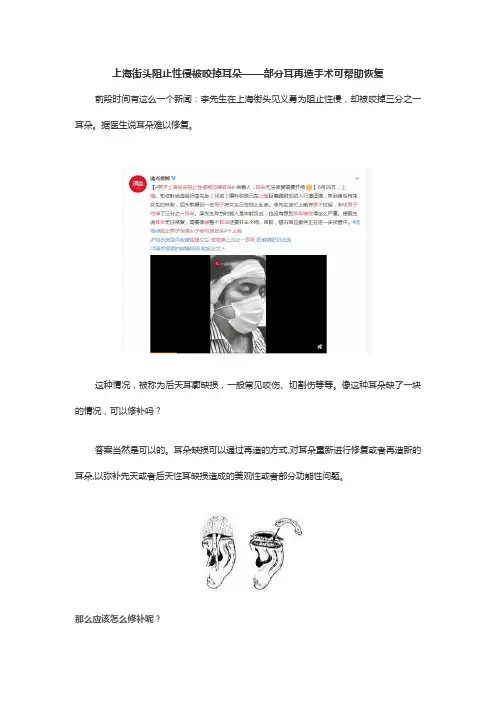 上海街头阻止性侵被咬掉耳朵——部分耳再造手术可帮助恢复