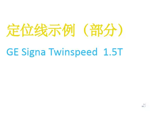 GE_1.5T磁共振操作指南定位线示例神经系统