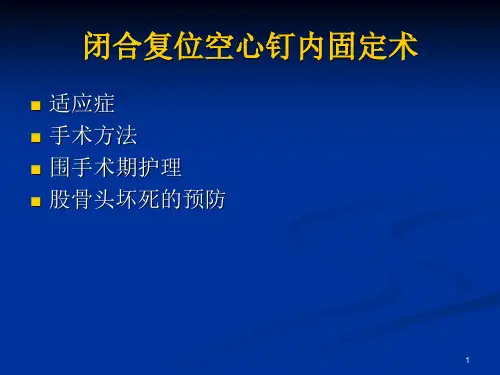 闭合复位空心钉内固定术PPT课件