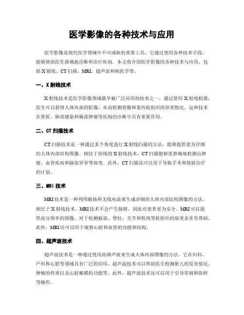 医学影像的各种技术与应用