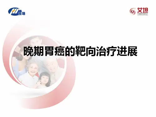 晚期胃癌的靶向治疗进展