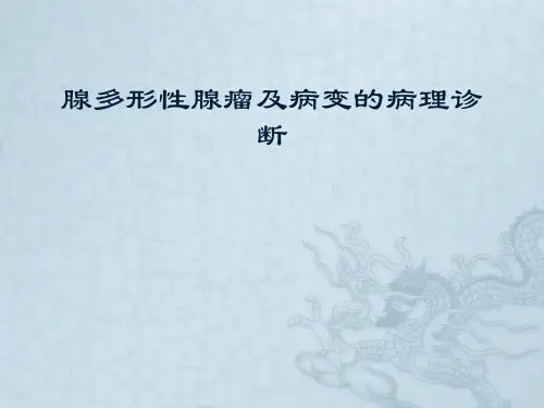 腺多形性腺瘤及病变的病理诊断