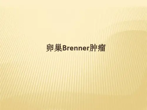 规培讲课Brenner肿瘤PPT课件
