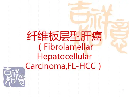 纤维板层型肝癌PPT课件