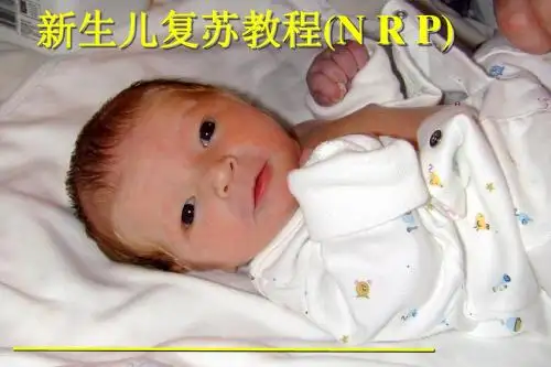 新生儿复苏教程(NPR)课件