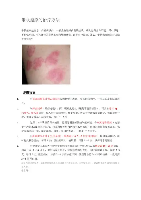 带状疱疹的治疗方法