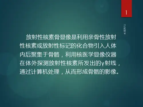 核医学全身骨显像骨显像PPT课件